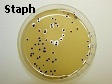 S aureus on Baird Parker Agar